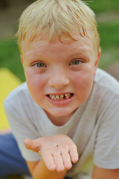 A kid with his first loose tooth 