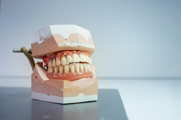 a denture model on a laboratory table. It is the upper and lower jaw.