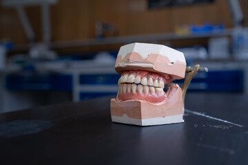 a denture model on a laboratory table with some working utensils. It is the upper and lower jaw. In the background you can see a laboratory - obrazy, fototapety, plakaty