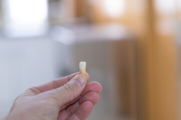 A hand holds an incisor tooth to work on a custom dental prosthesis. © LaMorenita