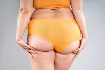 Overweight thigh, woman with fat hips and buttocks, obesity female body with cellulite on gray background - 771413833
