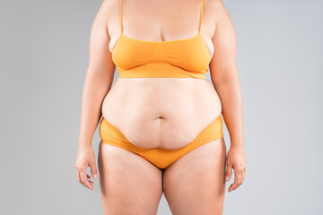 Tummy tuck, flabby skin on a fat belly, abdomen with obesity and cellulite, saggy stomach, plastic surgery concept on studio background - 771413897