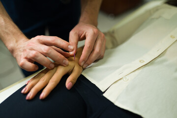Doctor giving acupuncture therapy on pressure points