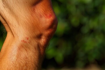 Fototapeta premium Close up of a knee with visible signs of swelling and redness emphasizing the need for prompt medical attention