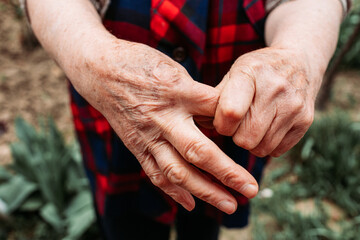 Elderly woman showing her cramped finger