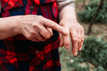 Elderly woman showing her hands joints