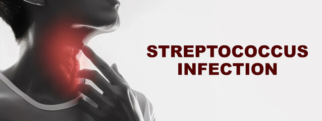 Japan strep throat infection outbreak deadly - obrazy, fototapety, plakaty