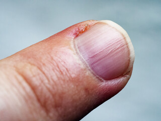 Close-up photo capturing the intricate details of skin and nail.