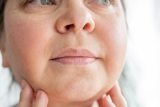 Double chin face mature woman 50 years old, human fat neck, side view, wrinkles on skin, facelift, age-related skin changes, aesthetic injection cosmetology, care anti-aging procedures