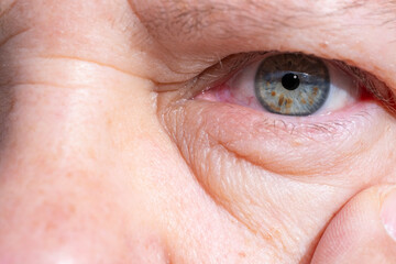 close-up mature female eye, revealing natural signs aging such wrinkles and puffiness under lower...