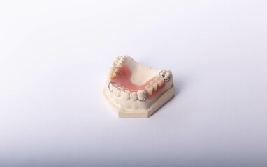 Dental cast during processing denture.