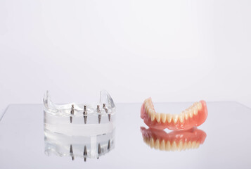 render of mandibular prosthesis all on 4 system supported by implants over white background