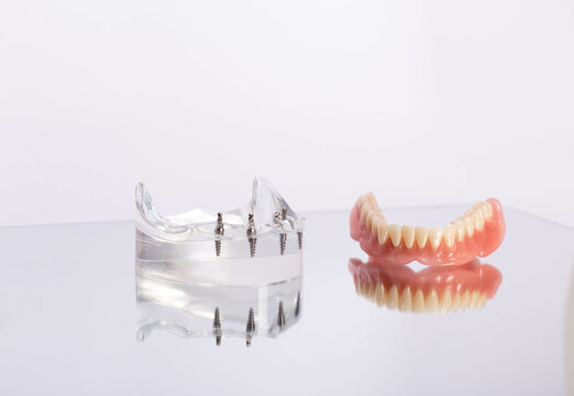 render of mandibular prosthesis all on 4 system supported by implants over white background