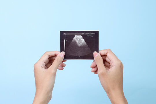 Woman hands holding ultrasound pregnancy image on blue background. Concept of pregnancy, maternity, expectation for baby birth.