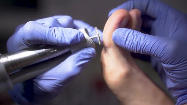 A podiatrist cleans a patient's feet 
