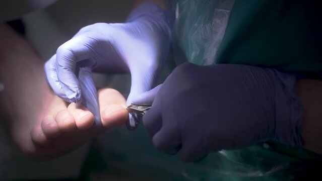 The podologist scrapes the nail with a buffing attachment