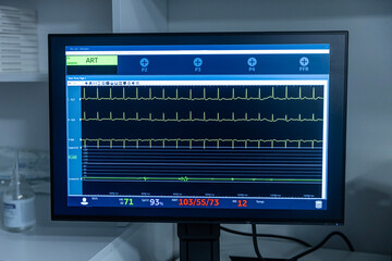 Modern equipment with vital signs monitors in operating room of contemporary clinic. Cardiogram...