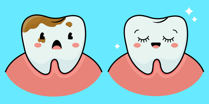 Two teeth, a diseased tooth and a healthy tooth. Vector illustration