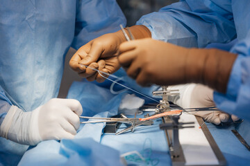 surgeons work on the cut part of the knee joint (muscular ligament) before implanting it back into...