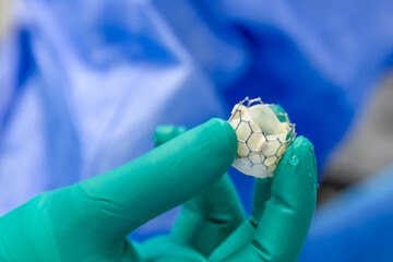 Heart valve surgery cardiology for patient in hospital. Prepare Transcatheter aortic valve...
