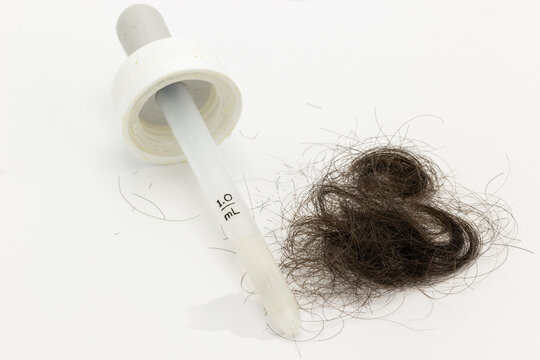 Minoxidil hair treatment dropper next to a pile of brown hair on a white background. This image can be used to illustrate topics related to hair loss, medical treatments and aging. 
