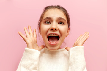 shocked teenage girl with braces screams with raised hands in fear on pink isolated background,...