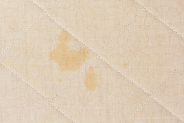 Yellow stains on white mattress cover