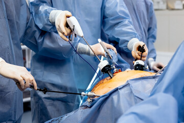 A group of medical surgeons in the operating room during an operation. A patient on the operating...