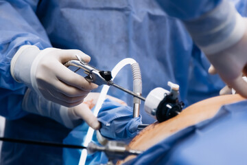 A group of medical surgeons in the operating room during an operation. A patient on the operating...