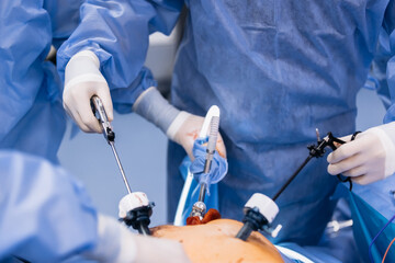 A medical team performs a surgical operation in a modern operating room. Concept of surgical...