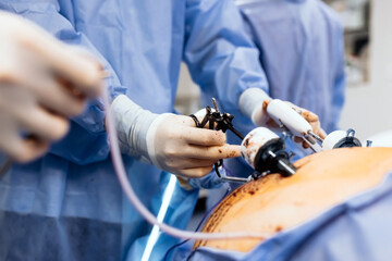 A medical team performs a surgical operation in a modern operating room. Concept of surgical...