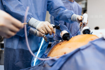 A group of medical surgeons in the operating room during an operation. A patient on the operating...