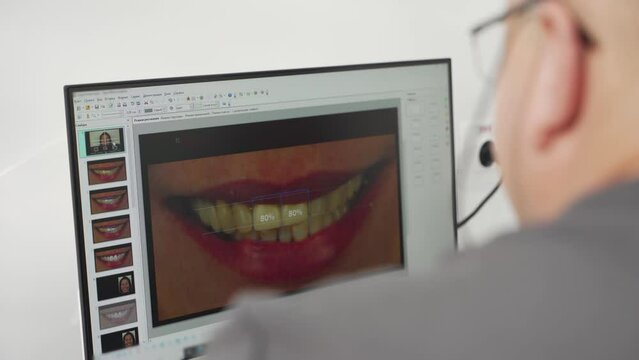 Photo of female patient's teeth smile on screen. Cosmetic dentist explains to patient process of modeling veneers in the modern dental clinic. Doctor showing photo of teeth to patient. Close-up.