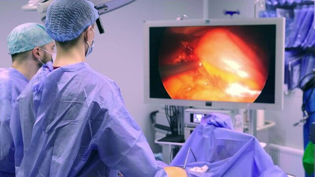 Instrument for laparoscopic surgery. A surgeon performs an operation using an endoscope on the stomach in a modern operating room.