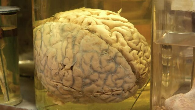 Real human brain. Anatomy of brain, grey substance, grey matter, cortical grey. Human brain in glass jar with formaldehyde for medical research