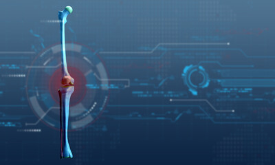 pain arthritis knee person people leg bone medicine inflammation joint disease health injury care medicine osteoarthritis ache body cramp physical sprain problem anatomy muscle injury therapy health 