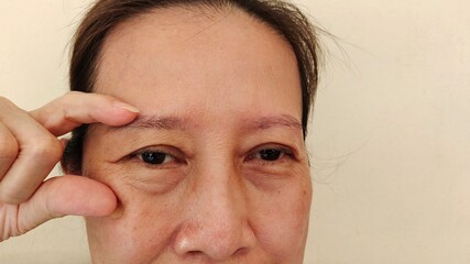 portrait showing the fingers holding the flabbiness and wrinkle beside the eyelid, swelling and loose under the eyes, dark spots and blemish on the face of the woman, health care and beauty concept.