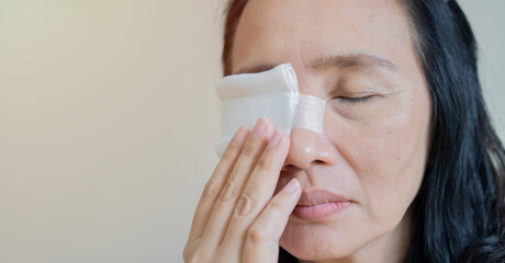 Close-up of an adult Asain woman having a gauze bandage on his right eye over light beige...
