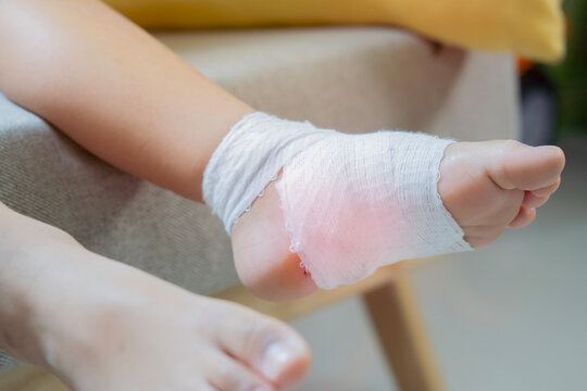 Cropped image of little boy' feet with gauze bandage. Selective focus.