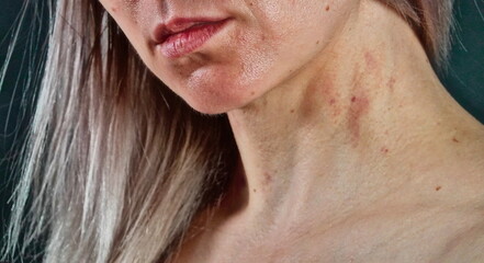 Close-Up Woman Skin Neck Detail Selective Focus