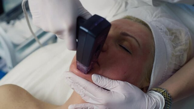 Precision Skin Rejuvenation: Fractional Radiofrequency Microneedling for Targeted Treatment of Hyperpigmentation, Wrinkles, Inflammatory Elements, Scars, Acne Post-Effects, and Enlarged Pores.