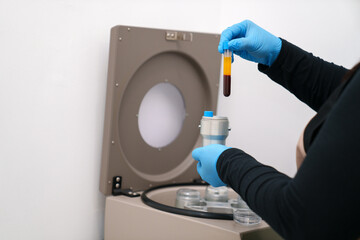Nurse inserting blood tube into a centrifuge for PRP