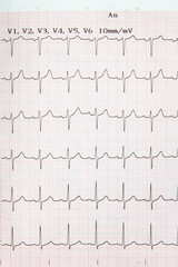 Electrocardiogram human heart. ECG medicine - 775059458