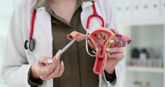 Model of the female reproductive system gynecologist holding pen and pointing to the uterus.