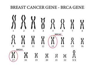 BRCA genes expression in breast cancer are located on chromosomes. 