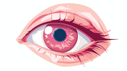 Conjunctivitis disease. Pink eye. Infection or allergy