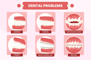 Dental Problems Illustration Collection