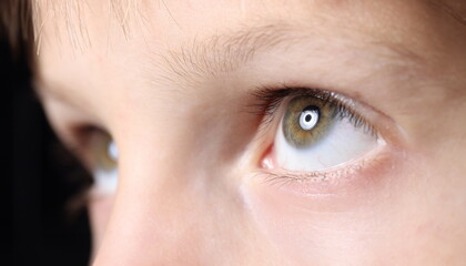 Close-up baby eyes look up. Treatment and correction of vision in children.