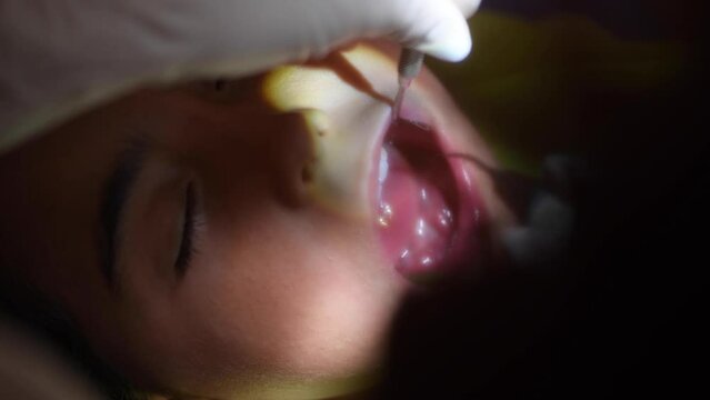 Young girl at the dentist during dental cleaning.Medicine, dentistry concept. Dental equipment, slow motion