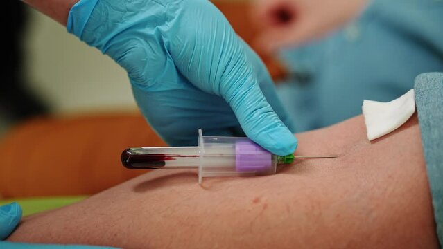 Female lab assistant in blue medical gloves collecting blood specimen, sample from male patient vein in medical laboratory. Blood flowing into tube. Concept of laboratory research, medicine, analysis